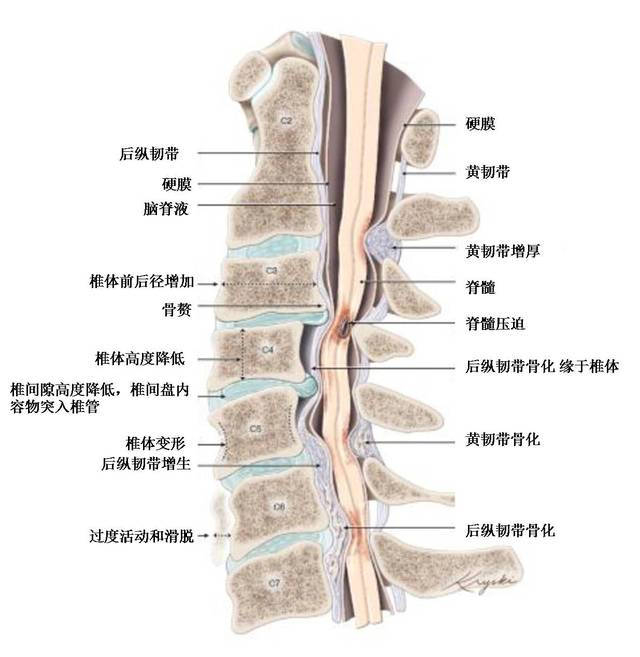 颈椎脊髓图
