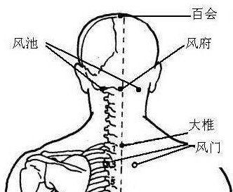 颈椎病贴敷穴位