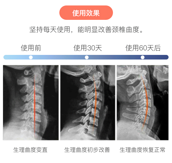 颈椎按摩器使用效果